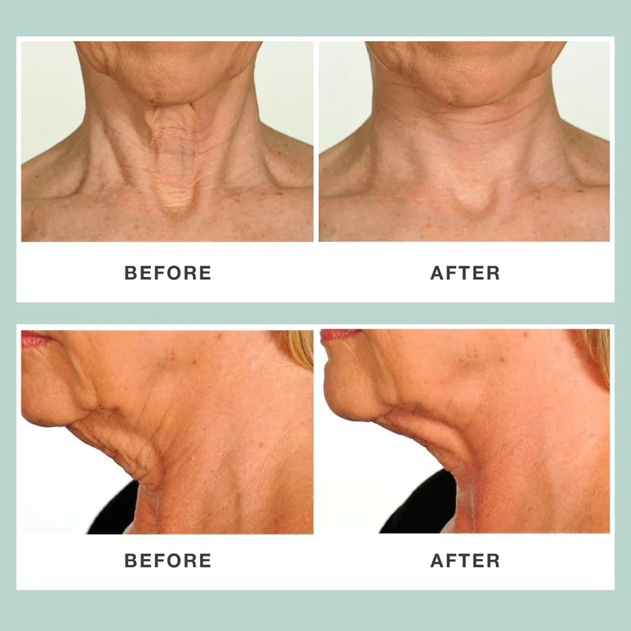 Contours Rx Neck Rescue 30 Strips - Professional Salon Brands