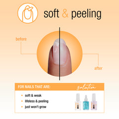 Nail Tek Nail Recovery For Soft Peeling Nails 3pc Kit - Professional Salon Brands
