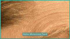 Contours Rx Microcrystal Patches (Set Of 4 Patches) - Professional Salon Brands