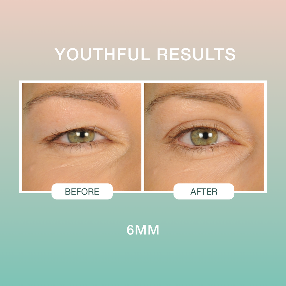 Contours Rx Lids By Design (80 Strips) – Professional Salon Brands