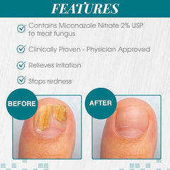 Nail Tek Anti Fungal Maximum Strength 10ml - Professional Salon Brands