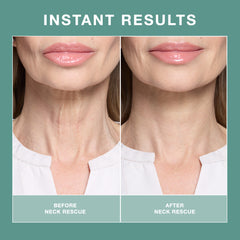 Contours Rx Neck Rescue 30 Strips - Professional Salon Brands